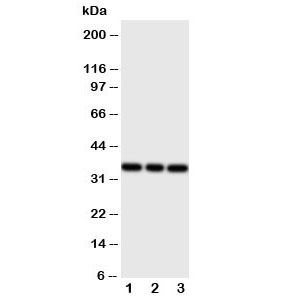 Western blot testing of Ibsp antibody and Lane 1:  rat liver;  2: rat brain;  3: rat kidney tissue lysate.  Expected molecular weight: 35~70 kDa depending on glycosylation level.