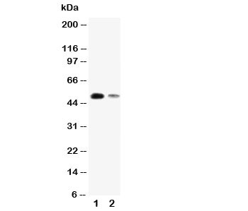 Western blot testing of KLF8 antibody and Lane 1:  SMMC-7721;  2: 293T cell lysate.  Predicted size ~40KD, Observed size ~50KD