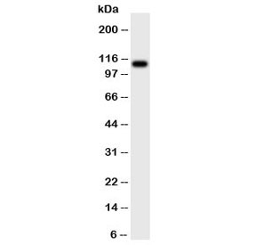 Western blot testing of CSF1R antibody and rat intestine tissue lysate.  Predicted molecular weight ~110 kDa.