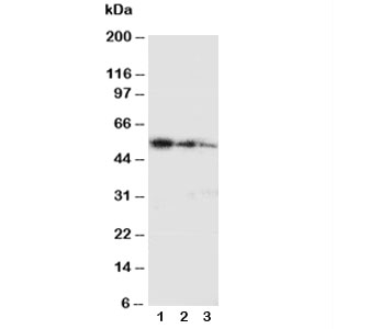 Western blot testing with Ki-67 antibody and partial human recombinant protein;  Lane 1: 10ng;  2: 5ng;  3: 2.5ng