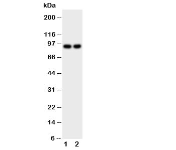 Western blot testing with Malt1 antibody; Lane 1: MCF-7;  2: HeLa cell lysate.  Expected molecular weight ~92 kDa.