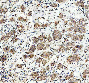 Western blot testing with MAP3K1 antibody and MCF-7 lysate.  Predicted/observed size ~162KD