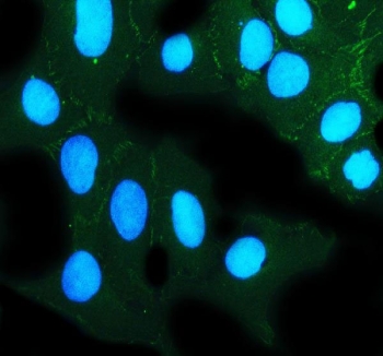 Immunofluorescent staining of FFPE human U-2 OS cells with ZO-2 antibody (green) and DAPI nuclear stain (blue). HIER: steam section in pH6 citrate buffer for 20 min.