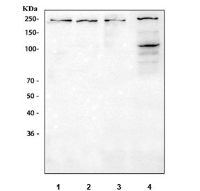 Western blot testing of 1) rat brain, 2) rat C6, 3) mouse brain and 4) mouse NIH 3T3 cell lysate with VEGFR1 antibody. Predicted molecular weight ~150 kDa but may be observed at higher molecular weights due to glycosylation.