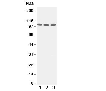 Western blot testing of ZO-3 antibody and Lane 1:  PANC;  2: A549;  3: HeLa cell lysate.  Predicted/observed size ~103KD
