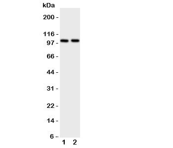 Western blot testing of ZO-3 antibody and Lane 1:  rat brain;  2: rat heart tissue lysate.  Predicted/observed size ~103KD