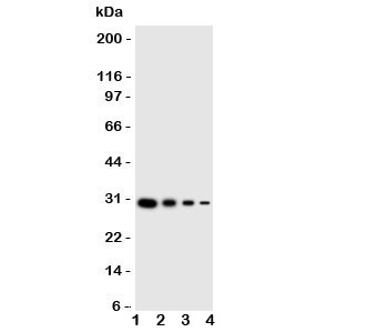 Western blot testing of LTK antibody and human recombinant protein;  Lane 1: 10ng;   2: 5ng;  3: 2.5ng;  4: 1.25ng