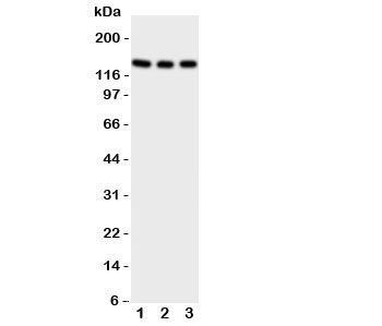 Western blot testing of TRKC antibody on Lane 1: rat brain;  2: mouse brain;  3: human U87 cell lysate.  Observed molecular weight 95~145 kDa depending on glycosylation level.