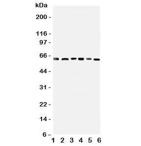 Western blot testing of PDK1 antbody on Lane 1: rat heart;  2: (r) skeletal muscle; and human samples 3: HeLa;  4: M231;  5: COLO320;  6: SW620 cell lysate. Predicted molecular weight ~49 kDa, observed here at ~64 kDa.