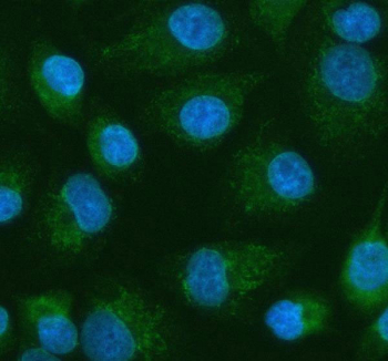 Immunofluorescent staining of FFPE human A549 cells with PDK2 antibody (green) and DAPI nuclear stain (blue). HIER: steam section in pH6 citrate buffer for 20 min.