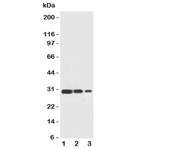 Western blot testing of TRAF2 antbody and recombinant human protein, 30.4KD with tag;  Lane 1: 10ng;  2: 5ng;  3: 2.5ng