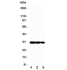 Western blot testing of TRAF3 antbody and Lane 1: Recombinant human protein 5ng;  2: 2.5ng;  3: 1.25ng