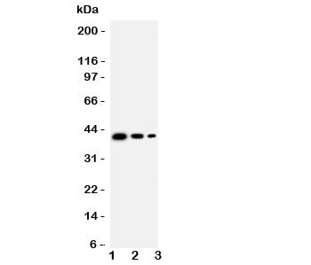 Western blot testing of TRAM2 antbody;  Lane 1: Recombinant mouse protein 10ng;  2: 5ng;  3: 2.5ng