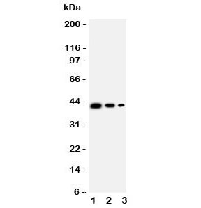 Western blot testing of CD68 antbody;  Lane 1: Recombinant human protein 10ng;  2: 5ng;  3: 2.5ng