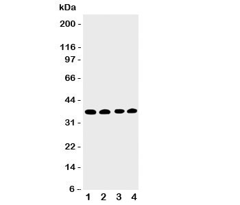 Western blot testing of EIF2S1 antbody; Lane 1: COLO320;  2: CEM;  3: Raji;  4: HT1080 cell lysate.  Predicted molecular weight: 36 kDa.