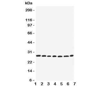 Western blot testing of EIF6 antbody; Lane 1: rat liver;  2: (r) kidney;  3: human COLO320;  4: (h) SW620;  5: (h) HeLa;  6: (h) 293T;  7: mouse HEPA cell lysate.  Expected molecular weight ~27 kDa.