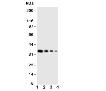 Western blot testing of LAT2 antbody;  Lane 1: Recombinant human protein 10ng;  2: 5ng;  3: 2.5ng;  4: 1.25ng
