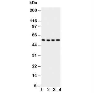 Western blot testing of Glut5 antbody;  Lane 1: U87;  2: 293T;  3: HT1080;  4: SW620 cell lysate. Expected/observed molecular weight ~55 kDa.