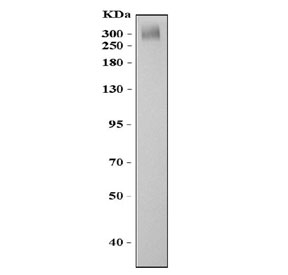 Western blot testing of ABCA4 antibody and mouse eye tissue lysate. Predicted molecular weight ~256 kDa but may be observed at higher molecular weights due to glycosylation.