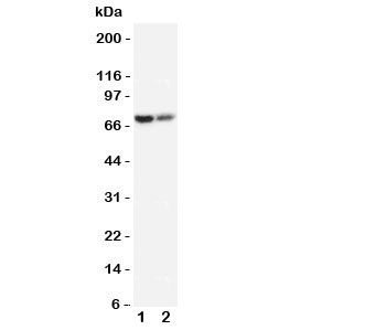 Western blot testing of PMP70 antibody and Lane 1:  rat lung;  2: rat ovary tissue lysate.  Predicted/observed size ~70KD