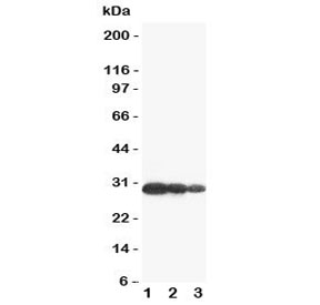 Western blot testing of Aquaporin 6 antibody and Lane 1:  U87;  2: COLO320;  3: MCF-7 cell lysate