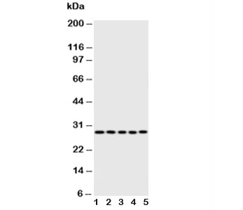 Western blot testing of Caspase-14 antibody;  Lane 1: rat brain;  2: rat liver;  3: rat spleen;  4: human A431;  5: mouse NIH3T3