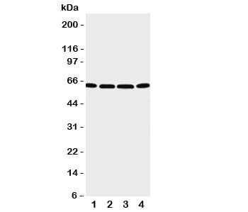 Western blot testing of P2X6 antibody and Lane 1:  U87;  2: 22RV1;  3: Jurkat;  4: HT1080 cell lysate.  Expected/observed size 49~70KD depending on glycosylation level