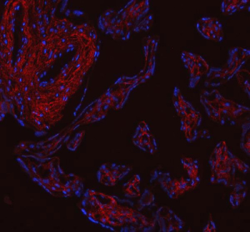 Immunofluorescent staining of FFPE human placental tissue with Collagen 1 antibody (red) and DAPI counterstain (blue). HIER: boil tissue sections in pH8 EDTA buffer, for 10-20 min and allow to cool before testing.