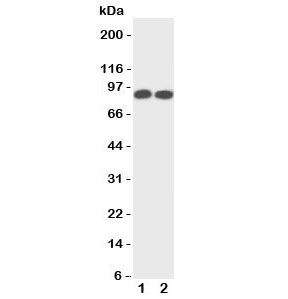 Western blot testing of TrkA antibody and Lane 1:  rat brain;  2: mouse brain tissue lysate. Observed molecular weight: 85~140 kDa depending on glycosylation level.