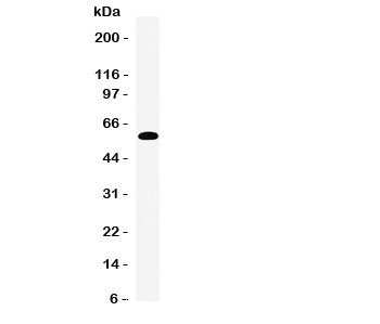 Western blot testing of EAAT3 antibody and human placenta tissue lysate.  Expected molecular weight: 57-70 kDa.