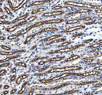 Western blot testing of NKCC2 antibody and rat kidney tissue lysate.  Expected/observed molecular weight ~121kDa.