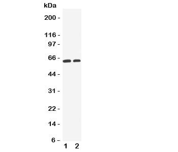 Western blot testing of OCT1 antibody and Lane 1:  human HeLa cell lysate;  2: human A549 cell lysate.  Predicted molecular weight ~61 kDa but this glycoprotein may be observed at up to ~80 kDa.