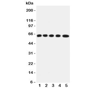 Western blot testing of OCTN2 antibody and Lane 1:  rat kidney;  2: (r) skeletal muscles;  3: mouse liver;  4: (m) HEPA;  5: (m) NIH3T3 cell lysate.  Expected/observed size ~63KD