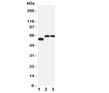 Western blot testing of SLC1A4 antibody and Lane 1:  human U87;  2: rat brain;  3: mouse brain tissue lysate.  Expected/observed size 60~80KD
