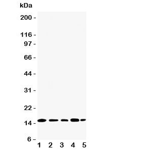 Western blot testing of TIA-1 antibody and Lane 1:  Jurkat;  2: Raji;  3: CEM;  4: HT1080;  5: K562 cell lysate.  Predicted molecular weight: ~43kDa and ~15kDa (granulocyte-associated isoform).