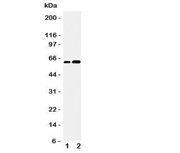 Western blot testing of CDC6 antibody and Lane 1:  Jurkat;  2: MCF-7 cell lysate.  Predicted/observed molecular weight: ~62kDa