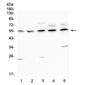 Western blot testing of AChR antibody and lysates from: 1) rat brain, 2) rat C6, 3) mouse RAW246.7, 4) human U-2 OS and 5) human SHG-44 cells. Predicted molecular weight ~51 kDa.
