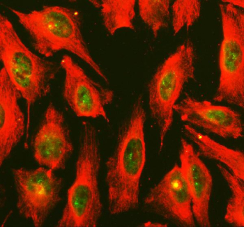 Immunofluorescent staining of FFPE human U-2 OS cells with IRF8 antibody (green) and Alpha Tubulin mAb (red). HIER: steam section in pH6 citrate buffer for 20 min.