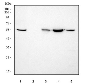 Western blot testing of 1) human HepG2, 2) human HUH7, 3) rat liver, 4) rat RH35 and 5) mouse liver tissue lysate with HNF6 antibody. Predicted molecular weight ~51 kDa.