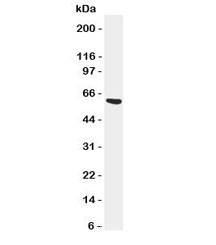 Western blot testing of SERPINA3 antibody and SMMC-7721 cell lysate.  Predicted molecular weight: 47/65kDa (unmodified/glycosylated).