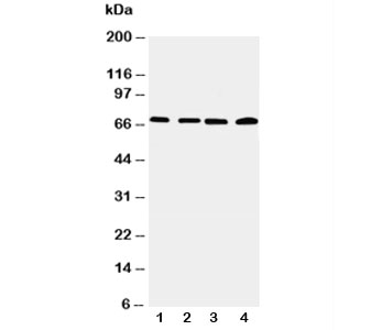 Western blot testing of IRAK2 antibody and Lane 1:  22RV;  2: A549;  3: PANC;  4: SMMC-7721 cell lysate