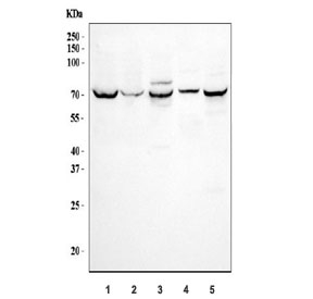 Western blot testing of 1) human HepG2, 2) human 293T, 3) rat kidney, 4) rat NRK and 5) mouse kidney tissue lysate with SGLT1 antibody.  Expected molecular weight: ~73 kDa.