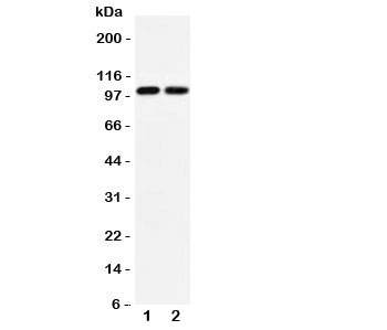 Western blot testing of GLUR3 antibody and Lane 1:  rat brain;  2: mouse brain lysate.  Predicted/observed size ~99KD