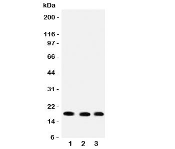 Western blot testing of UBC9 antibody and rat samples 1: heart;  2: skeletal muscle;  3: pancreas lysate.  Predicted/expected size ~18KD