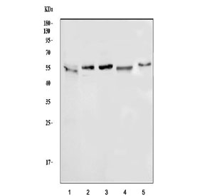 Western blot testing of 1) human PANC-1, 2) human HT1080, 3) human U-251, 4) rat C6 and 5) mouse testis tissue lysate with ATG5 antibody. Predicted molecular weight ATG5: ~32 kDa; ATG5/ATG12 heterodimer: ~56 kDa.