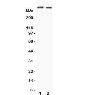 Western blot testing of Huntingtin antibody and Lane 1:  human HeLa cell lysate and  2: human U-87 MG cell lysate.  Predicted molecular weight: ~350 kDa.