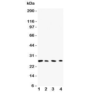 Western blot testing of Rab3C antibody and Lane 1:  rat brain;  2: human HeLa;  3: (h) 293T;  4: (h) COLO320 lysate.  Expected/observed size ~26KD