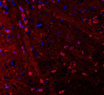 Immunofluorescent staining of FFPE rat brain tissue with PSD-95 antibody (red) and DAPI nuclear stain (blue). HIER: steam section in pH6 citrate buffer for 20 min.