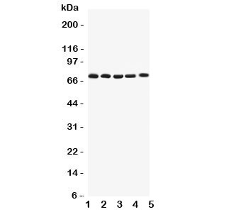 Western blot testing of Kv1.4 antibody and Lane 1:  rat brain;  2: human HY1080;  3: (h) PANC;  4: (h) U87;  5: (h) SHG-44 lysate