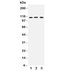 Western blot testing of human 1) COLO320, 2) MCF-7 and 3) PANC lysate with TRPC4 antibody at 0.5ug/ml.  Predicted molecular weight: ~112 kDa.